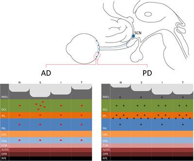 Retinal Ganglion Cells and Circadian Rhythms in Alzheimer’s Disease, Parkinson’s Disease, and Beyond